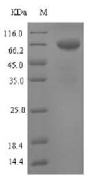 SDS-PAGE (TPH1-1723M).jpg